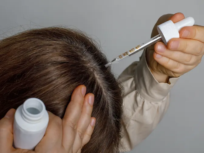 Dunner wordend haar: wanneer volume langzaam verdwijnt